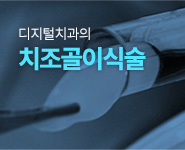 디지털치과의 치조골이식술