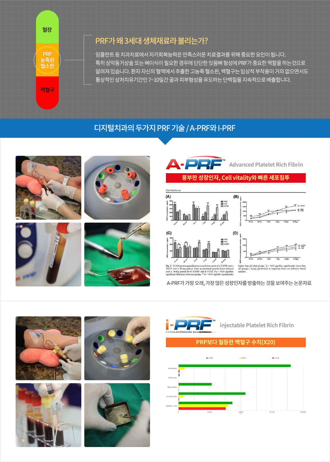 자가혈(PRF)의 힘