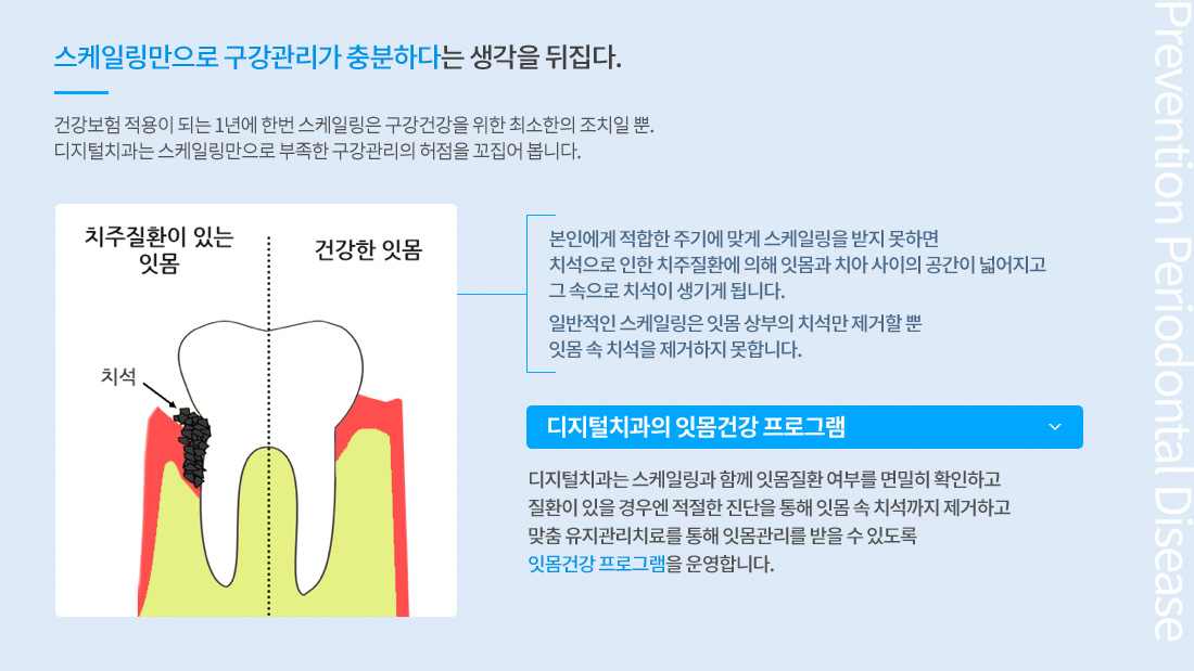 클린 스케일링