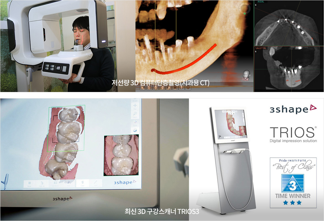 특별한 디지털 임플란트