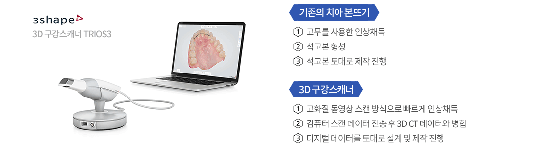 특별한 디지털 임플란트