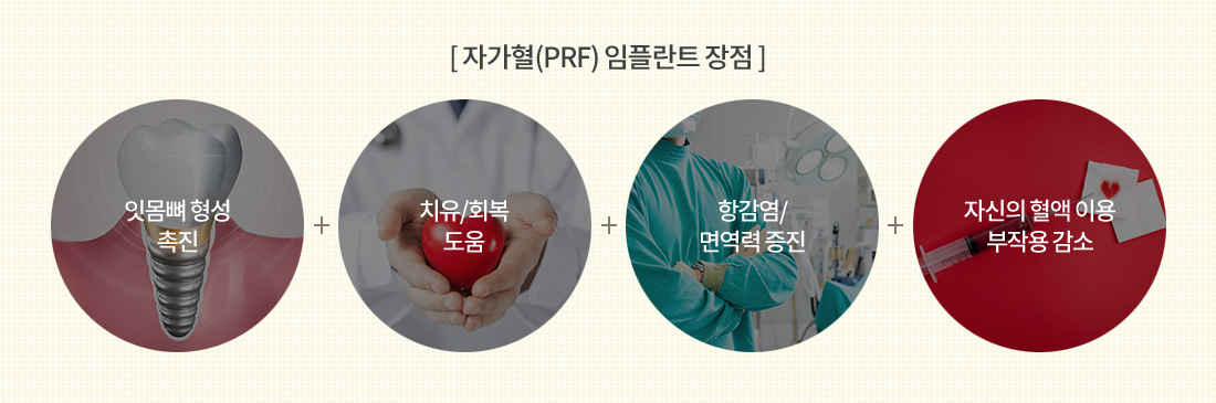 자가혈(PRF) 임플란트