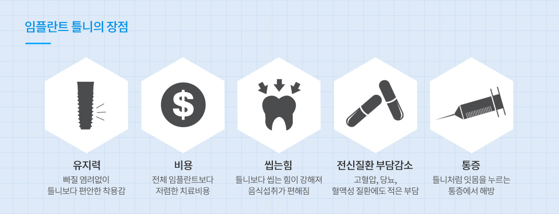 디지털 임플란트 틀니