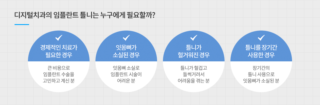 디지털 임플란트 틀니