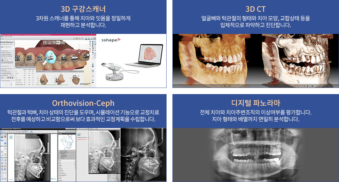 디지털 3D 치아교정