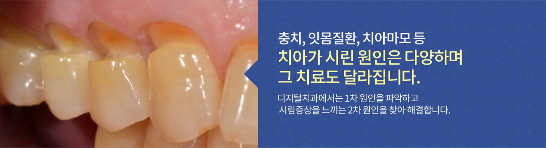http://digital-clinic.co.kr/sub5_2.html 시린이 집중 치료