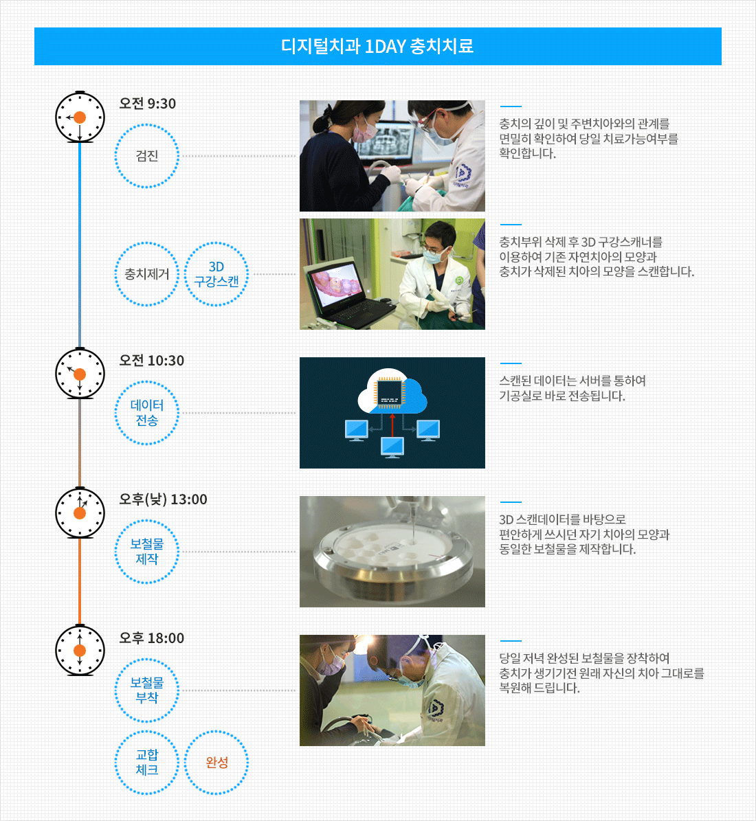 원데이 충치 치료